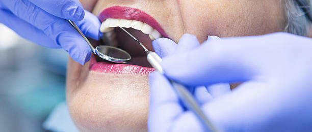 Best Teeth Whitening  in Sebewaing, MI