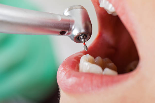 Best Root Canal Emergency Dentist  in Sebewaing, MI